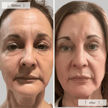 Load image into Gallery viewer, Omnilux - Contour Face