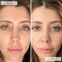 Load image into Gallery viewer, Omnilux - Contour Face