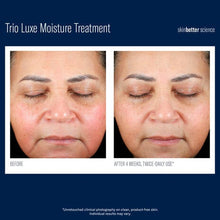 Load image into Gallery viewer, Skinbetter - Trio Luxe Moisture Treatment 50ml