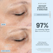 Load image into Gallery viewer, NuFACE - FIX® Line Smoothing Device