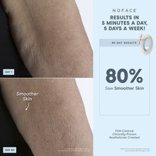 Load image into Gallery viewer, NuFACE - NuBODY® Body Toning Device + Aqua Gel Actovator 10oz
