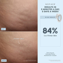 Load image into Gallery viewer, NuFACE - NuBODY® Body Toning Device + Aqua Gel Actovator 10oz