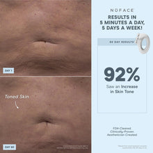 Load image into Gallery viewer, NuFACE - NuBODY® Body Toning Device + Aqua Gel Actovator 10oz