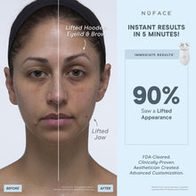Load image into Gallery viewer, NuFACE - TRINITY+ PRO Complete Set