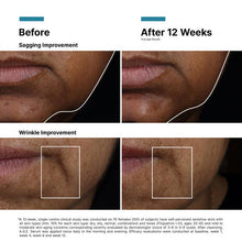 Load image into Gallery viewer, SkinCeuticals - AGE Interrupter Ultra Serum 30ml