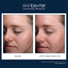 Load image into Gallery viewer, Skinbetter - AlphaRet Clearing Serum 30ml
