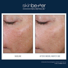 Load image into Gallery viewer, Skinbetter - AlphaRet Overnight Cream 30ml