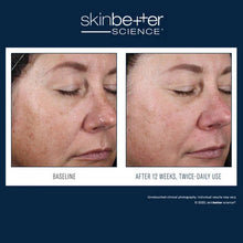 Load image into Gallery viewer, Skinbetter - Alto Advanced Defense and Repair Serum  30ml