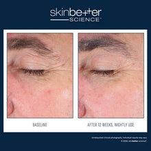 Load image into Gallery viewer, Skinbetter - EyeMax AlphaRet Overnight Cream 15ml