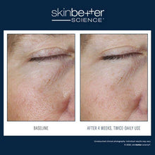 Load image into Gallery viewer, Skinbetter - Instant Effect Gel EYE 15ml