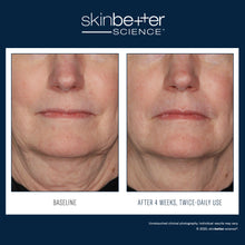Load image into Gallery viewer, Skinbetter - InterFuse Treatment Cream FACE & NECK 30ml