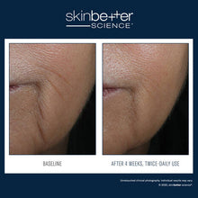 Load image into Gallery viewer, Skinbetter - InterFuse Intensive Treatment LINES 15ml