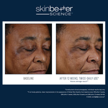 Load image into Gallery viewer, Skinbetter - Mystro Active Balance Serum 30ml