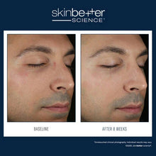 Load image into Gallery viewer, Skinbetter - Solo Hydrating Defense MEN 50ml