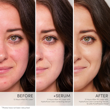 Load image into Gallery viewer, Jane Iredale - HydroPure™ Color Correcting Serum with Hyaluronic Acid & CoQ10