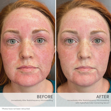 Load image into Gallery viewer, Jane Iredale - HydroPure™ Color Correcting Serum with Hyaluronic Acid & CoQ10