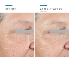 Load image into Gallery viewer, SkinCeuticals - A.G.E. Advanced Eye