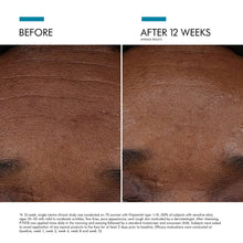 Load image into Gallery viewer, SkinCeuticals - P-TIOX