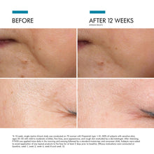 Load image into Gallery viewer, SkinCeuticals - P-TIOX