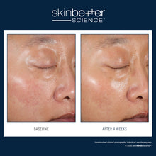 Load image into Gallery viewer, Skinbetter - Duo Kit 30 ml
