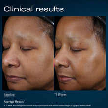 Load image into Gallery viewer, Skinbetter - Ampra Volumizing Macro HA Serum 30ml

