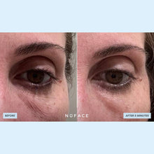 Load image into Gallery viewer, NuFACE - IonPlex® Hydra-Gel Power Patches - Eye Masks 3.2oz
