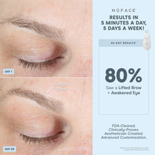 Load image into Gallery viewer, NuFACE - TRINITY+ PRO Effective Lip &amp; Eye Attachment
