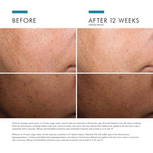 Load image into Gallery viewer, SkinCeuticals - Discoloration Defense
