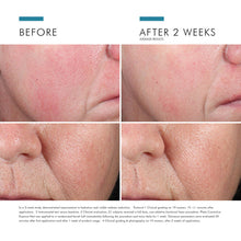 Load image into Gallery viewer, SkinCeuticals - Phyto Corrective Essence Mist
