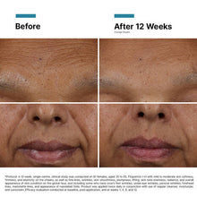 Load image into Gallery viewer, SkinCeuticals - HA Intensifier Multi-Glycan 30ml
