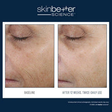 Load image into Gallery viewer, Skinbetter - Even Tone Correcting Serum 50ml
