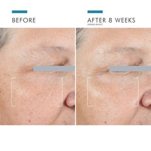 Load image into Gallery viewer, SkinCeuticals - A.G.E. Advanced Eye
