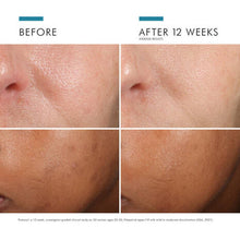 Load image into Gallery viewer, SkinCeuticals - Phloretin CF® with Ferulic Acid
